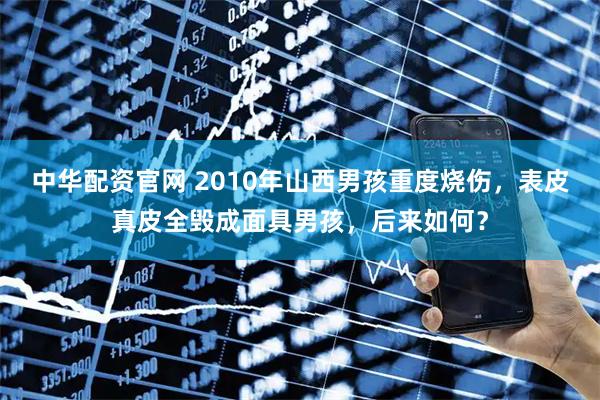 中华配资官网 2010年山西男孩重度烧伤，表皮真皮全毁成面具男孩，后来如何？